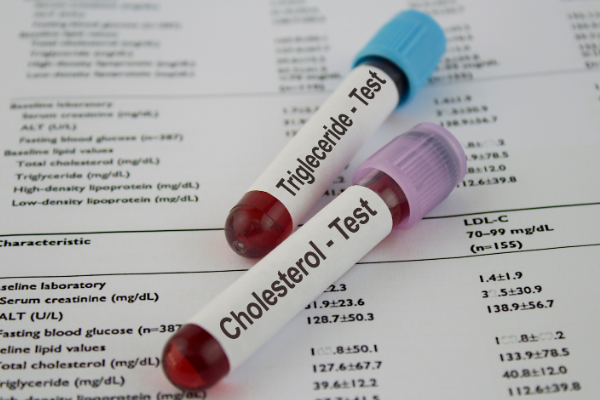 Cholesterolverlagende middelen en bijwerkingen